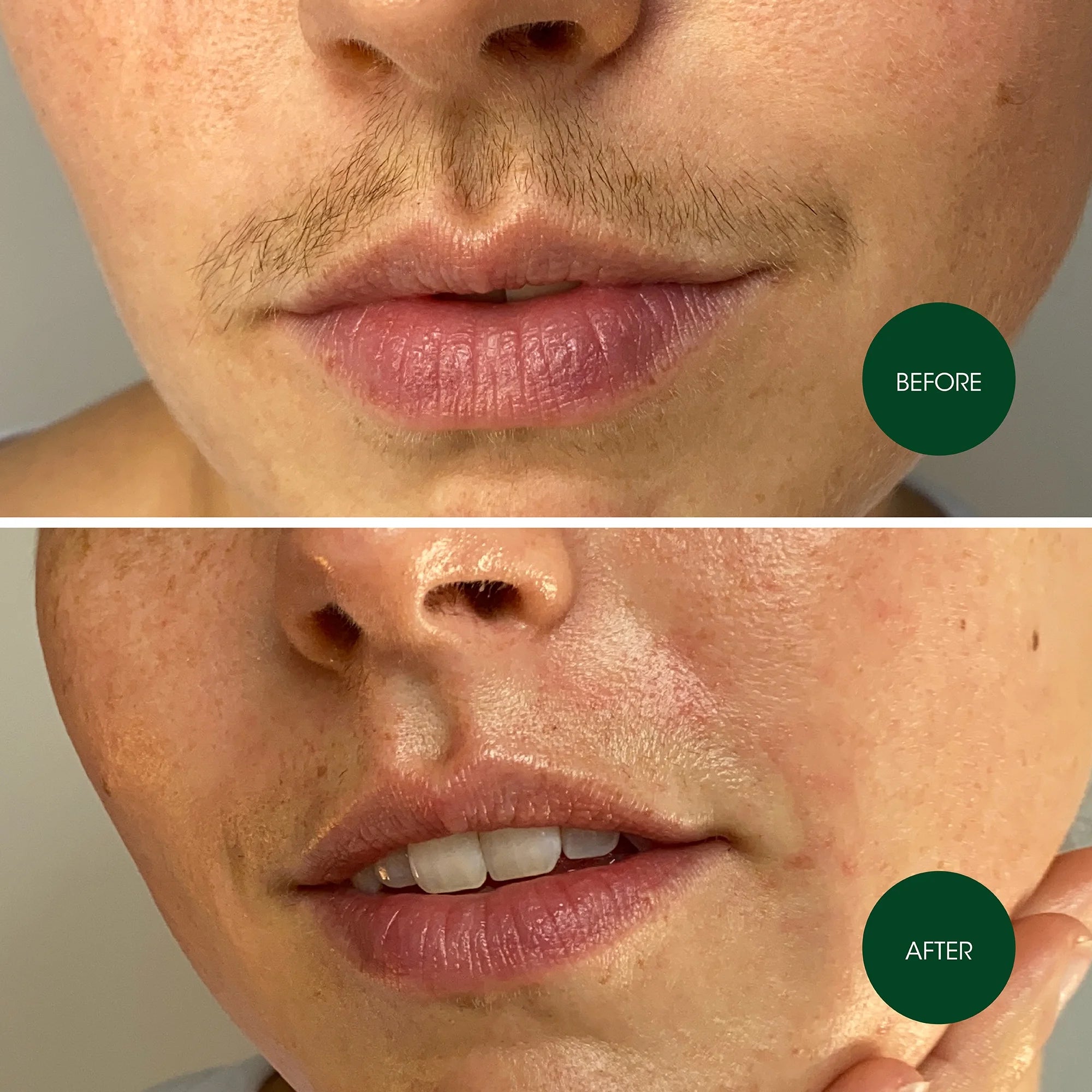 Facial Wax Strips 20 Pack for Women'S Facial Hair Removal with 4 Calming Oil Wipes + Skin Protection Powder